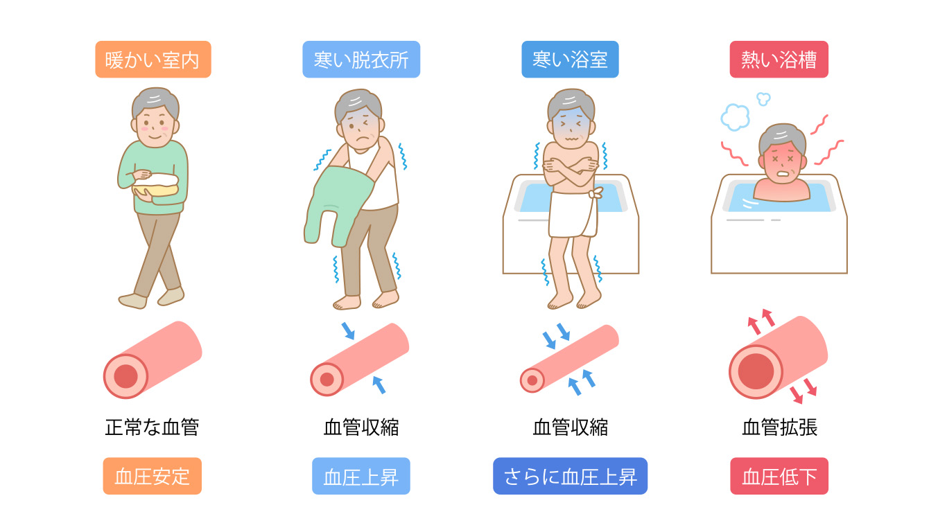 ヒートショックが起こりやすいタイミング
